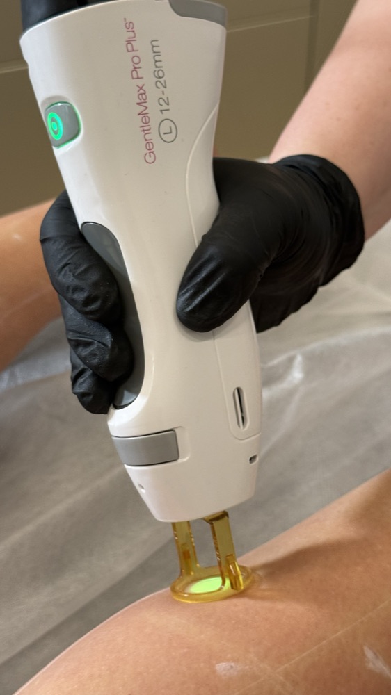 Candela GentleMax Pro Plus Laser